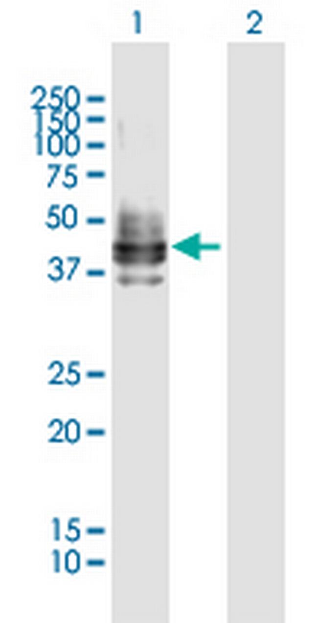 CD2 Antibody in Western Blot (WB)