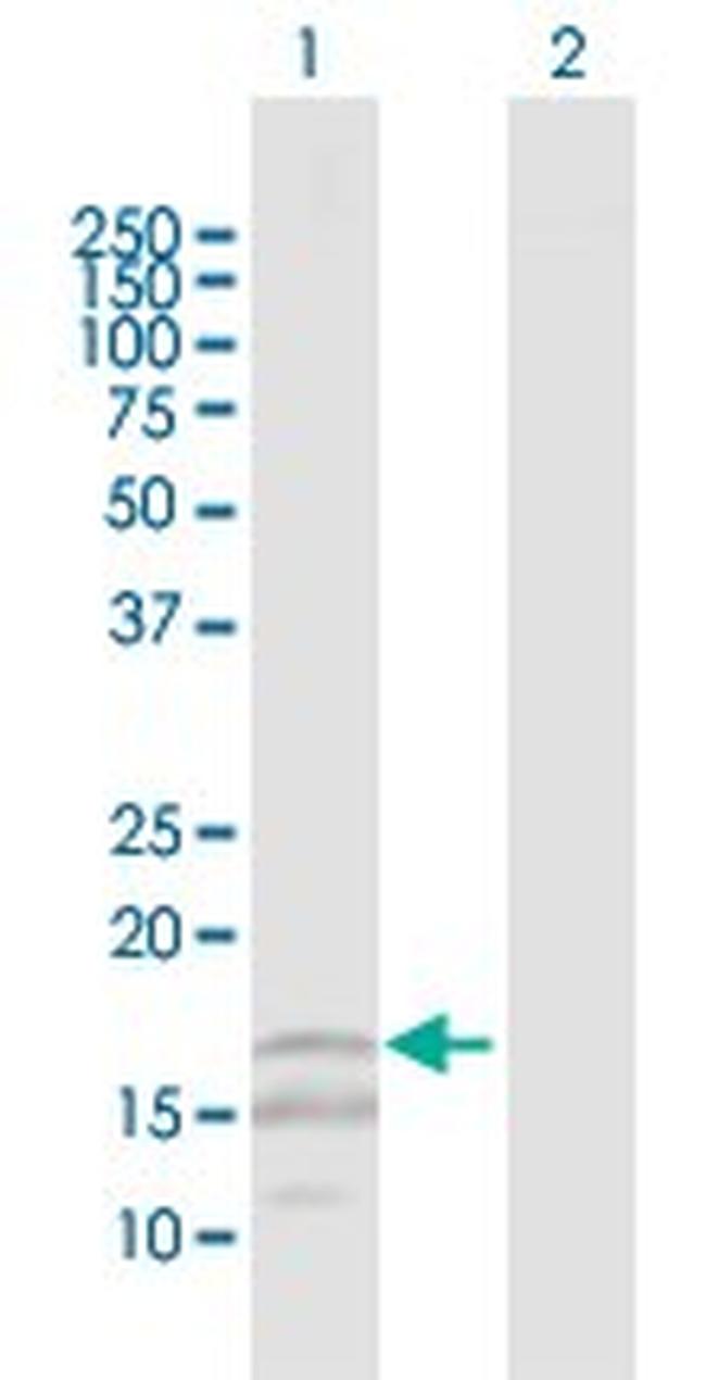 CD247 Antibody in Western Blot (WB)