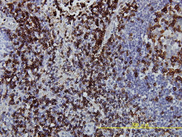 CD3Z Antibody in Immunohistochemistry (Paraffin) (IHC (P))