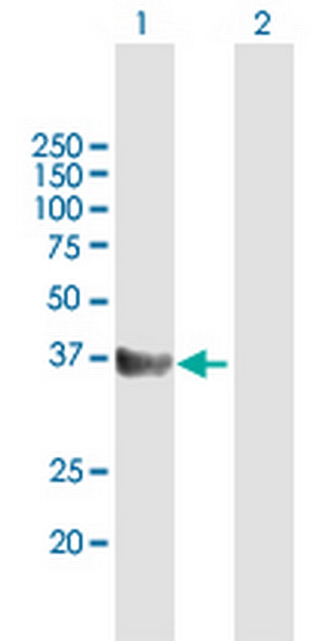 CD5L Antibody in Western Blot (WB)