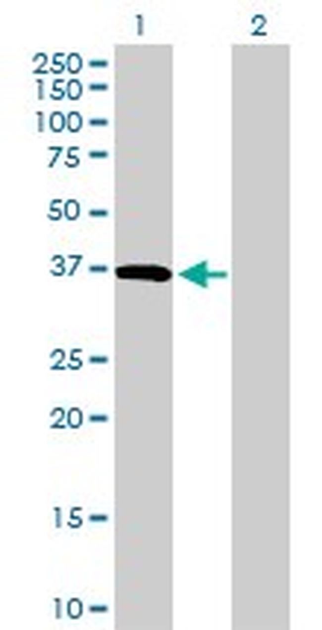 CD5L Antibody in Western Blot (WB)