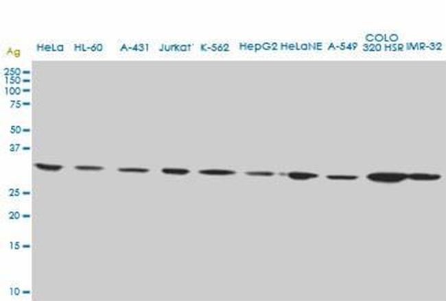 CD5L Antibody in Western Blot (WB)