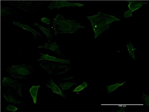 CD19 Antibody in Immunocytochemistry (ICC/IF)