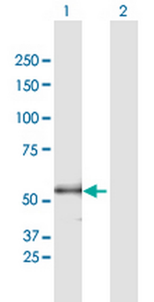 ENTPD3 Antibody in Western Blot (WB)