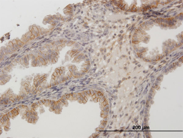 CD44 Antibody in Immunohistochemistry (Paraffin) (IHC (P))