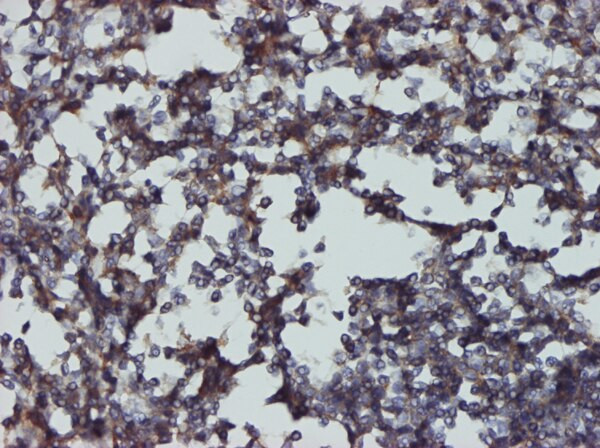 CD48 Antibody in Immunohistochemistry (Paraffin) (IHC (P))
