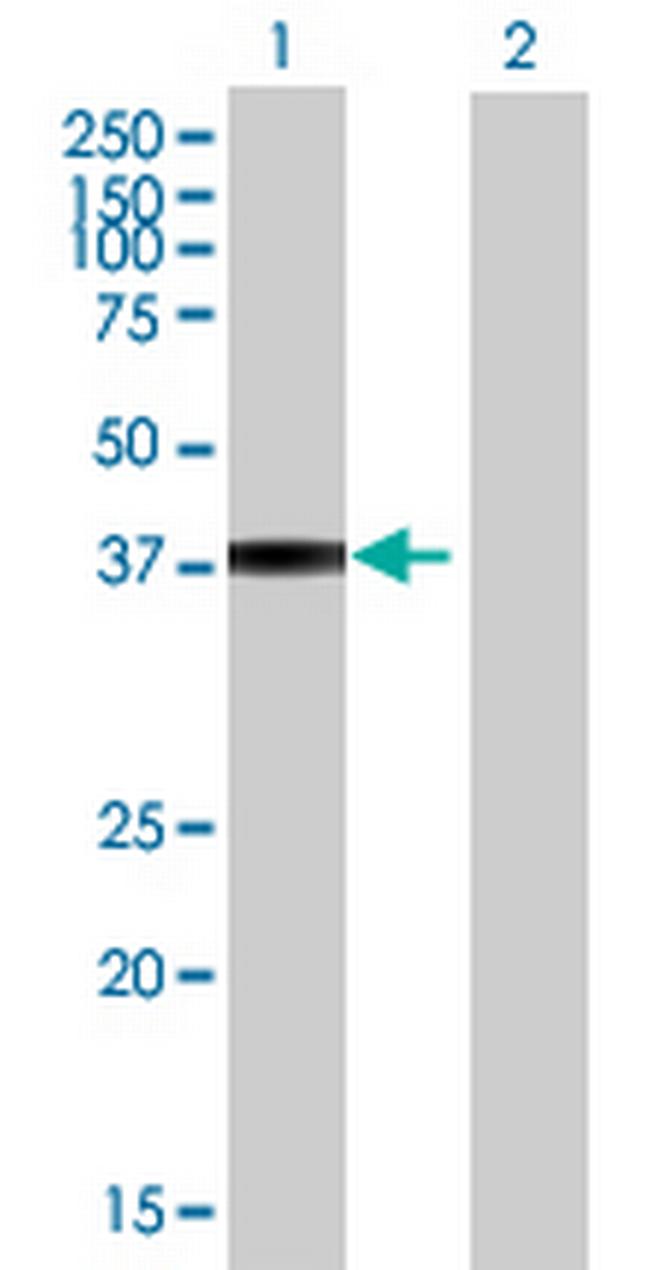 CD58 Antibody in Western Blot (WB)
