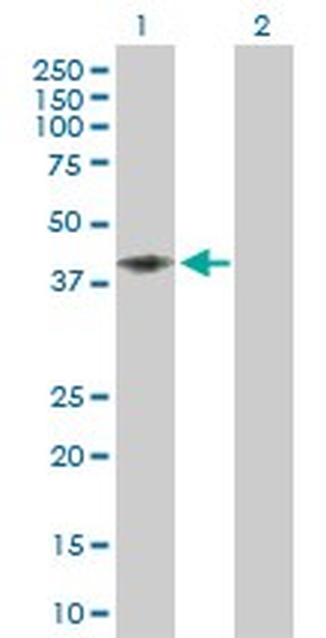 CD58 Antibody in Western Blot (WB)