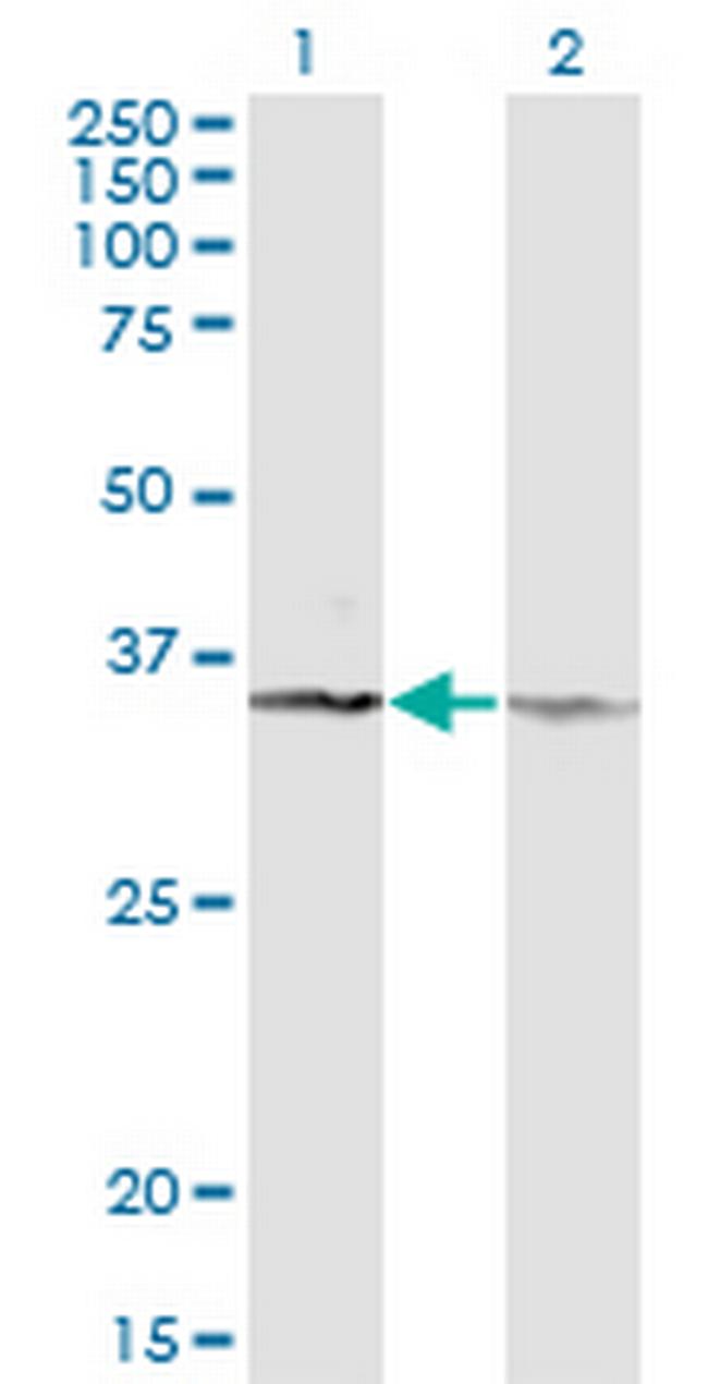 CD58 Antibody in Western Blot (WB)