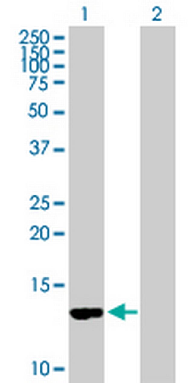 CD59 Antibody in Western Blot (WB)