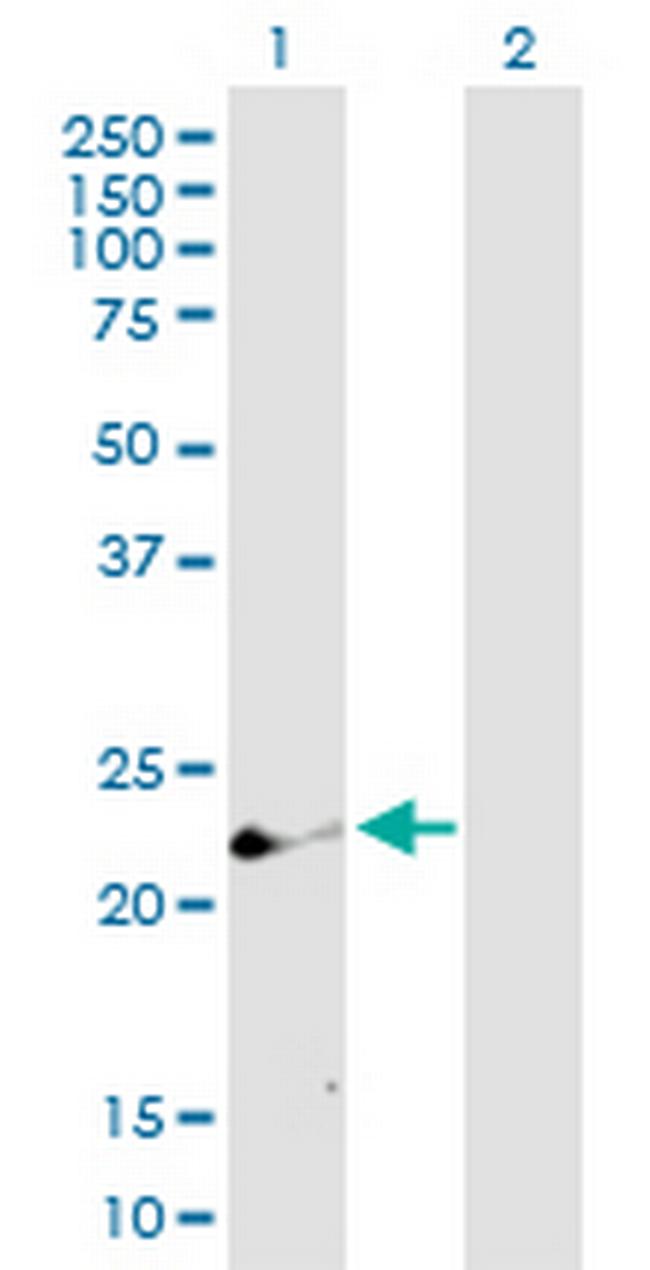 CD69 Antibody in Western Blot (WB)
