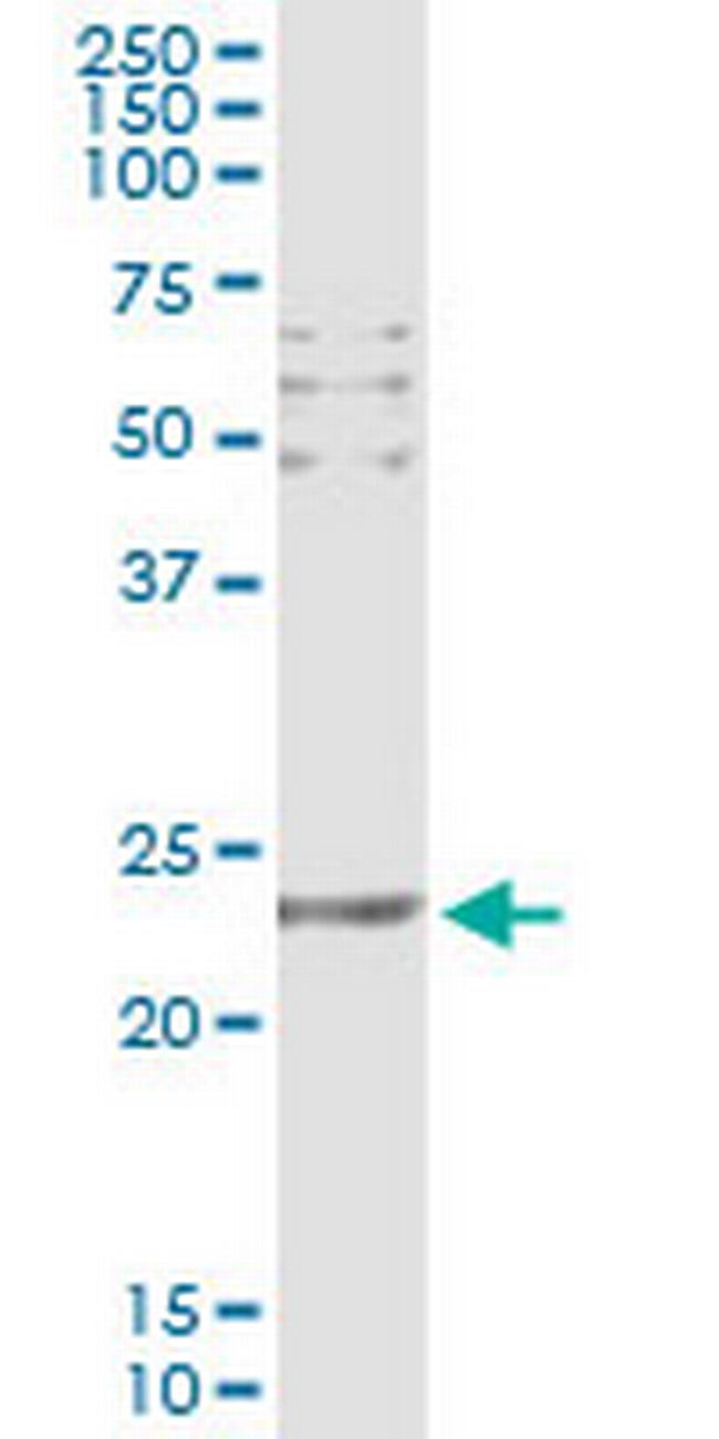 CD69 Antibody in Immunoprecipitation (IP)