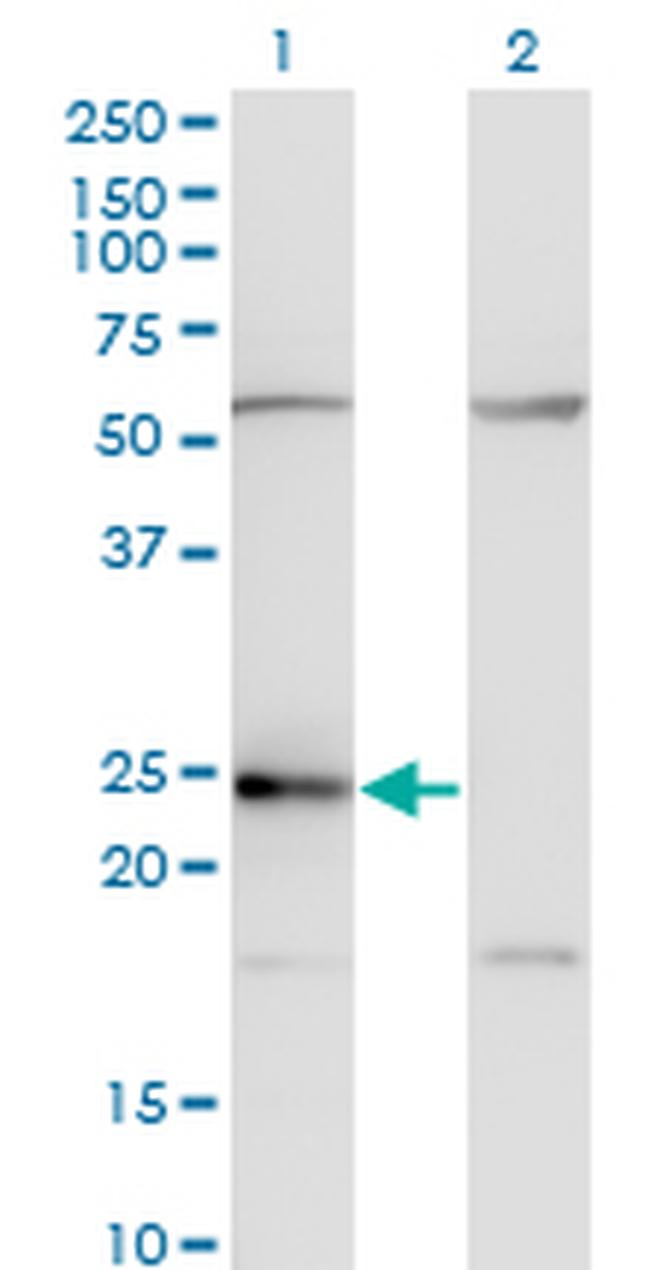 CD74 Antibody in Western Blot (WB)