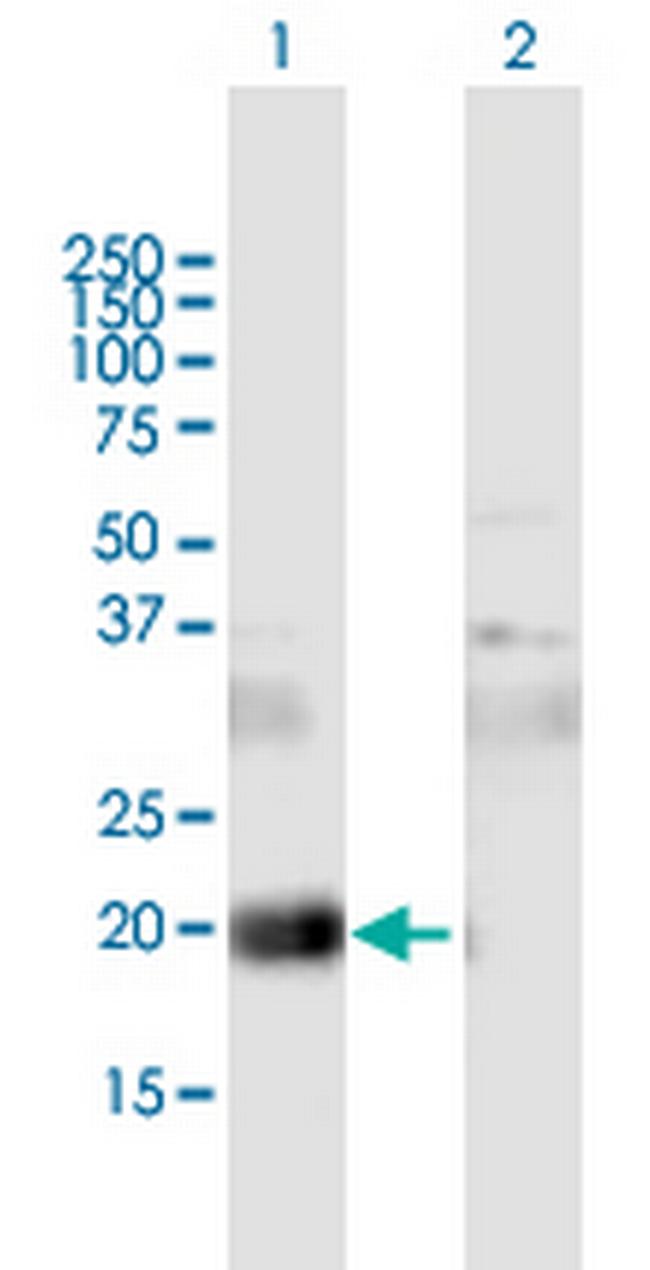 CD81 Antibody in Western Blot (WB)