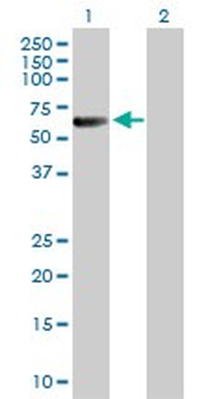 CDC25C Antibody in Western Blot (WB)