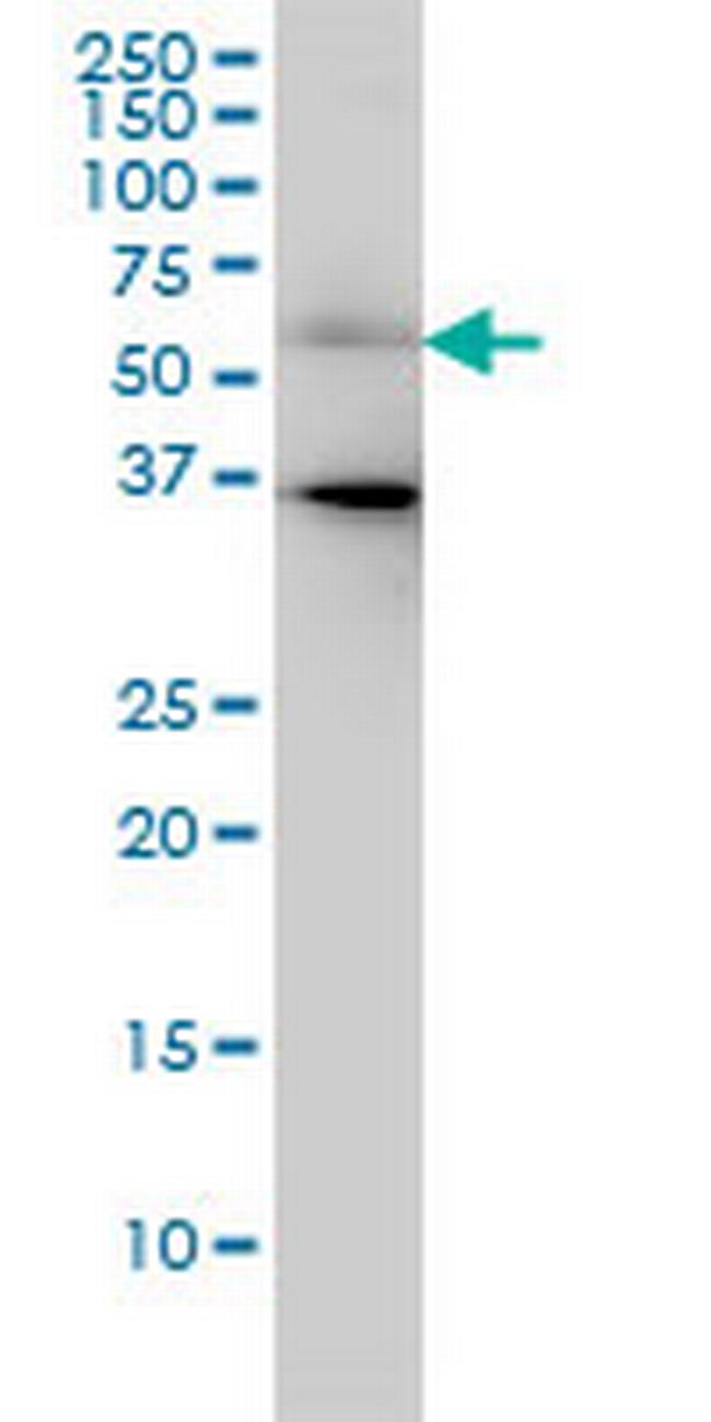 CDC25C Antibody in Western Blot (WB)