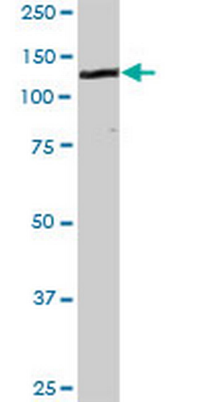 CDH1 Antibody in Western Blot (WB)