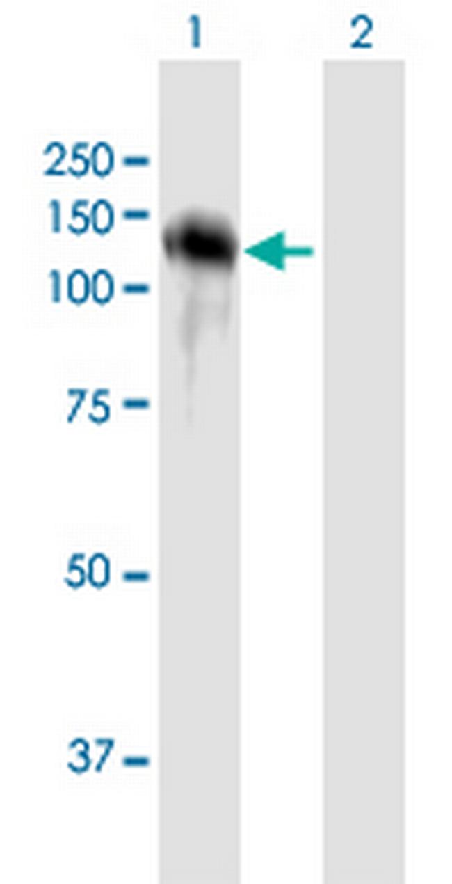 CDH16 Antibody in Western Blot (WB)