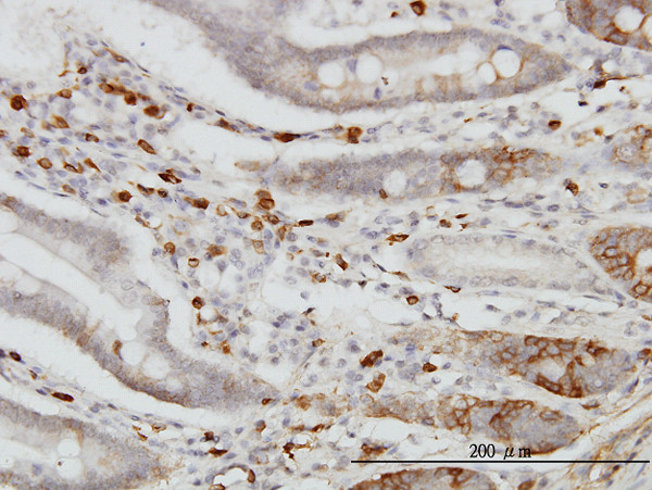 CDH18 Antibody in Immunohistochemistry (Paraffin) (IHC (P))