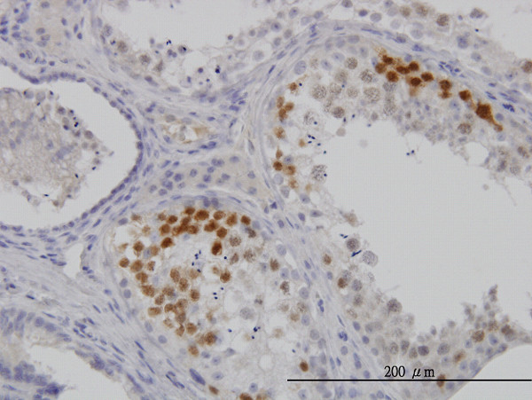CDK3 Antibody in Immunohistochemistry (Paraffin) (IHC (P))