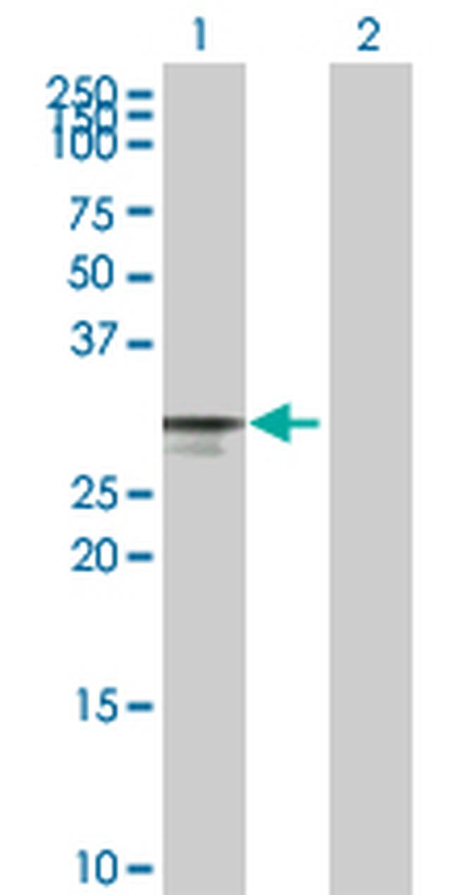 CDK4 Antibody in Western Blot (WB)