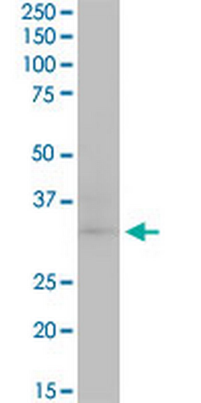 CDK4 Antibody in Western Blot (WB)
