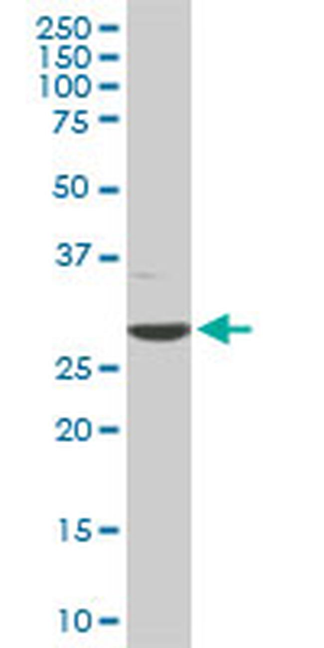 CDK4 Antibody in Western Blot (WB)