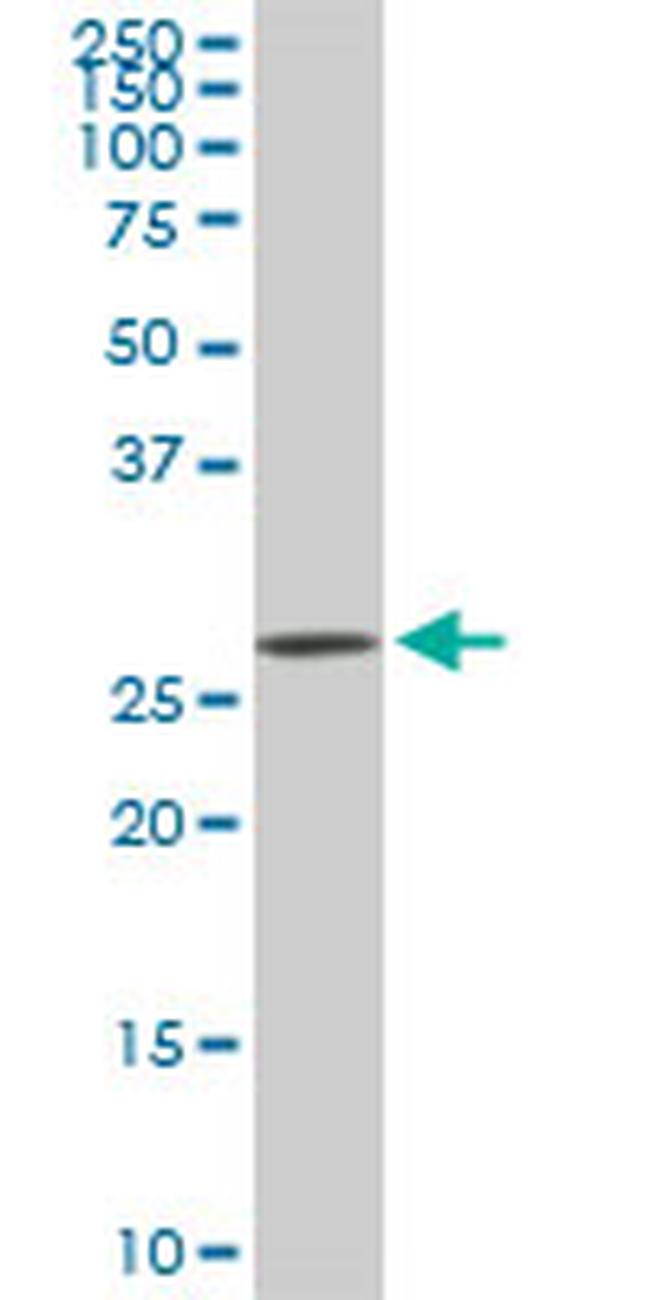 CDK4 Antibody in Western Blot (WB)