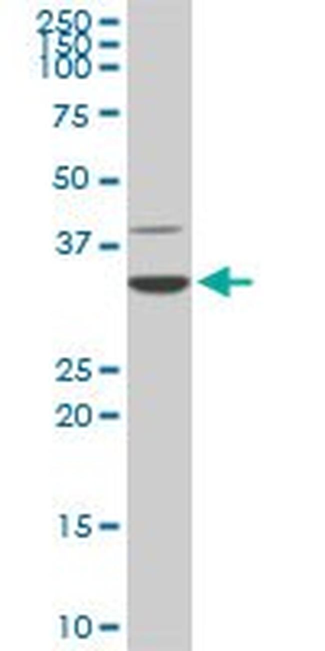 CDK4 Antibody in Western Blot (WB)