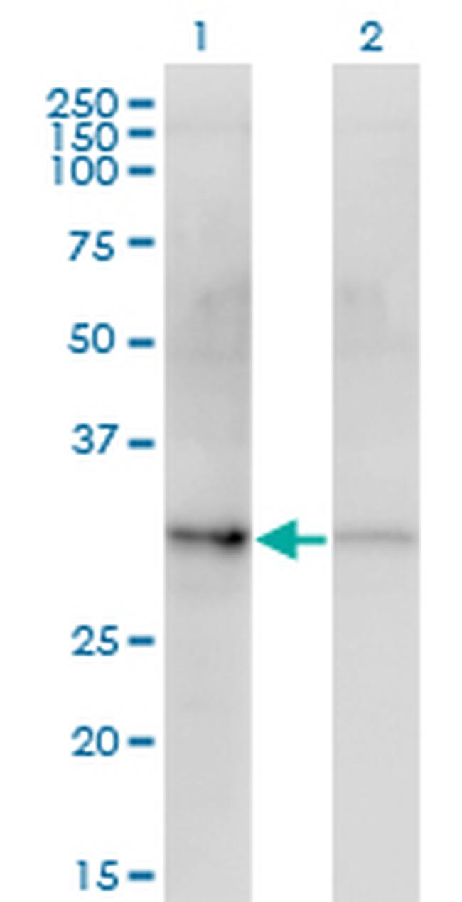 CDK4 Antibody in Western Blot (WB)