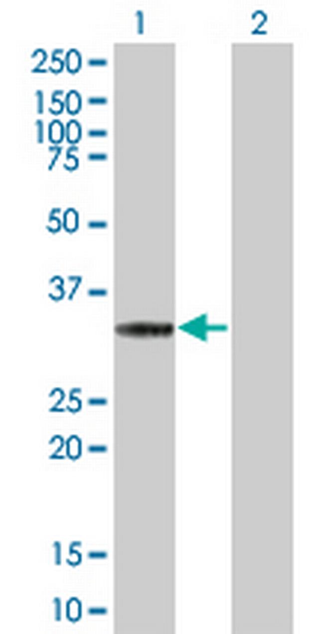 CDK5 Antibody in Western Blot (WB)