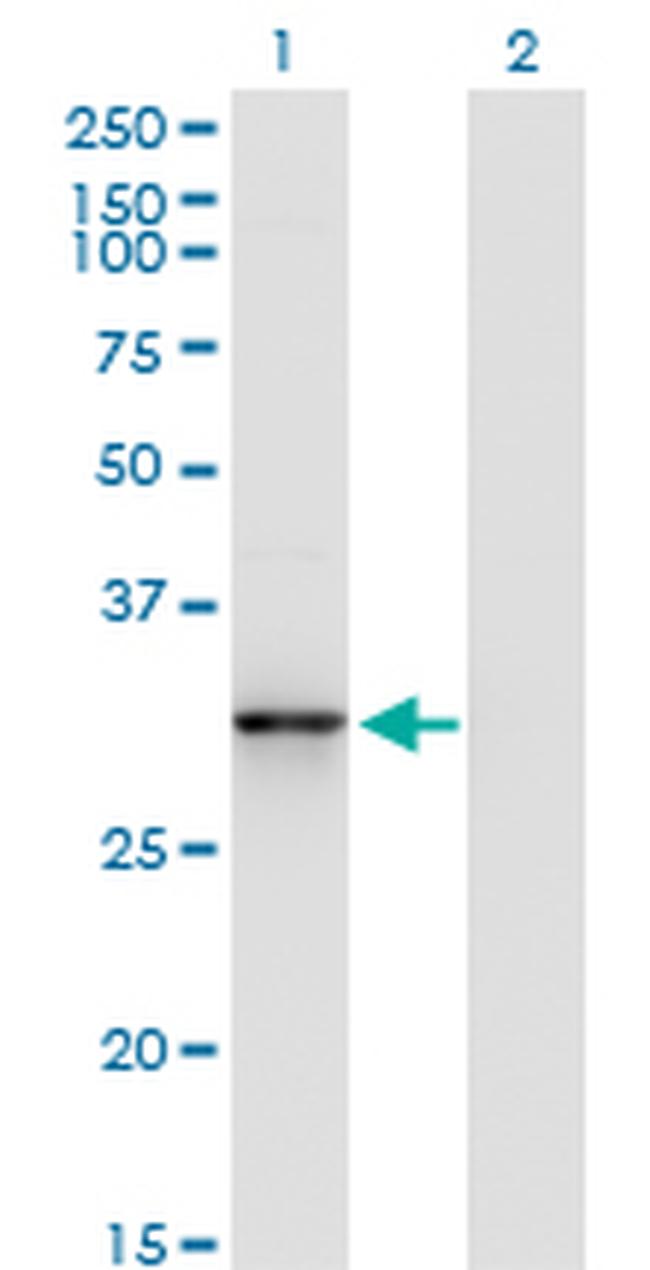 CDK5 Antibody in Western Blot (WB)