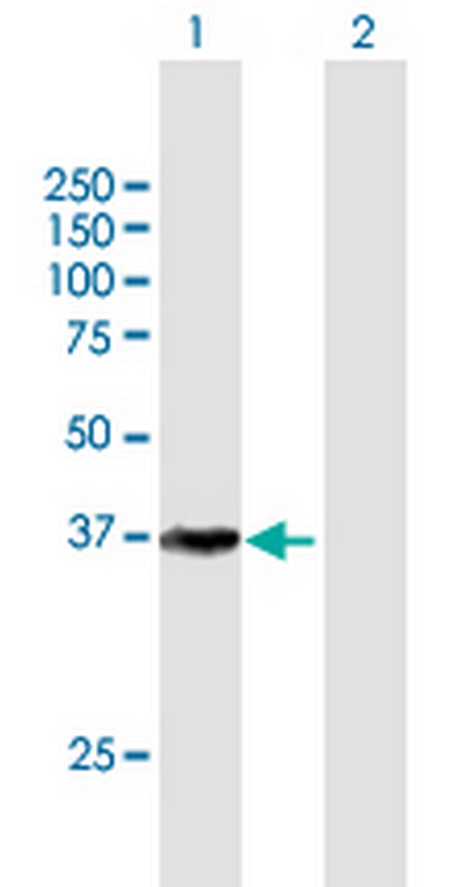 CDK7 Antibody in Western Blot (WB)