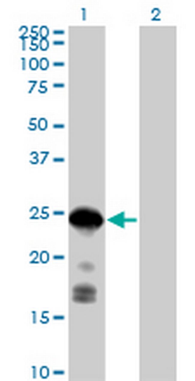 CDKN1B Antibody in Western Blot (WB)