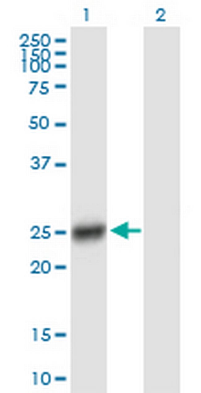 CDKN1B Antibody in Western Blot (WB)