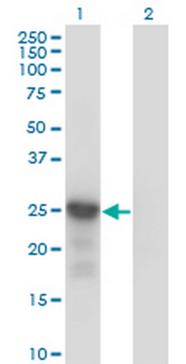 CDKN1B Antibody in Western Blot (WB)