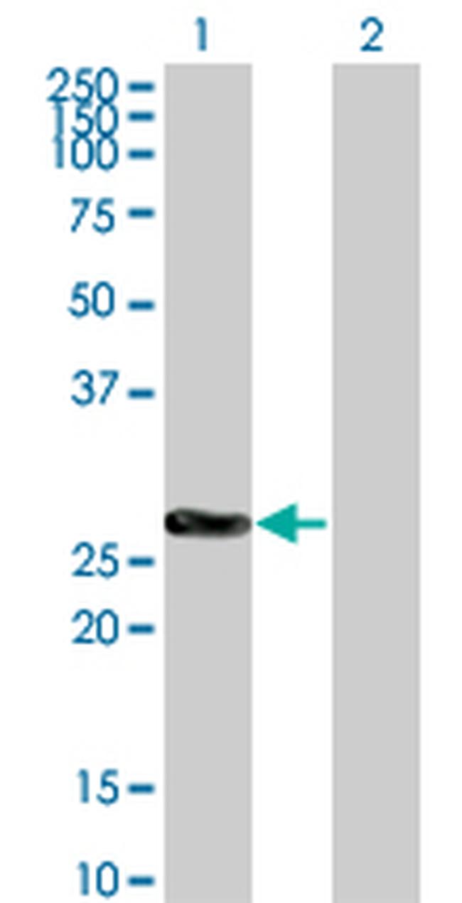 CDKN1B Antibody in Western Blot (WB)