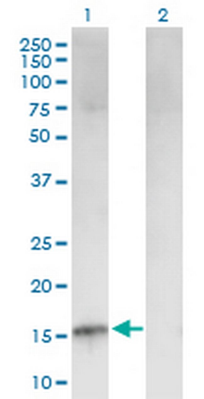 CDKN2B Antibody in Western Blot (WB)