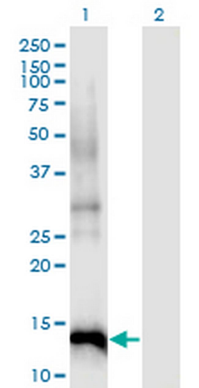 CDKN2B Antibody in Western Blot (WB)