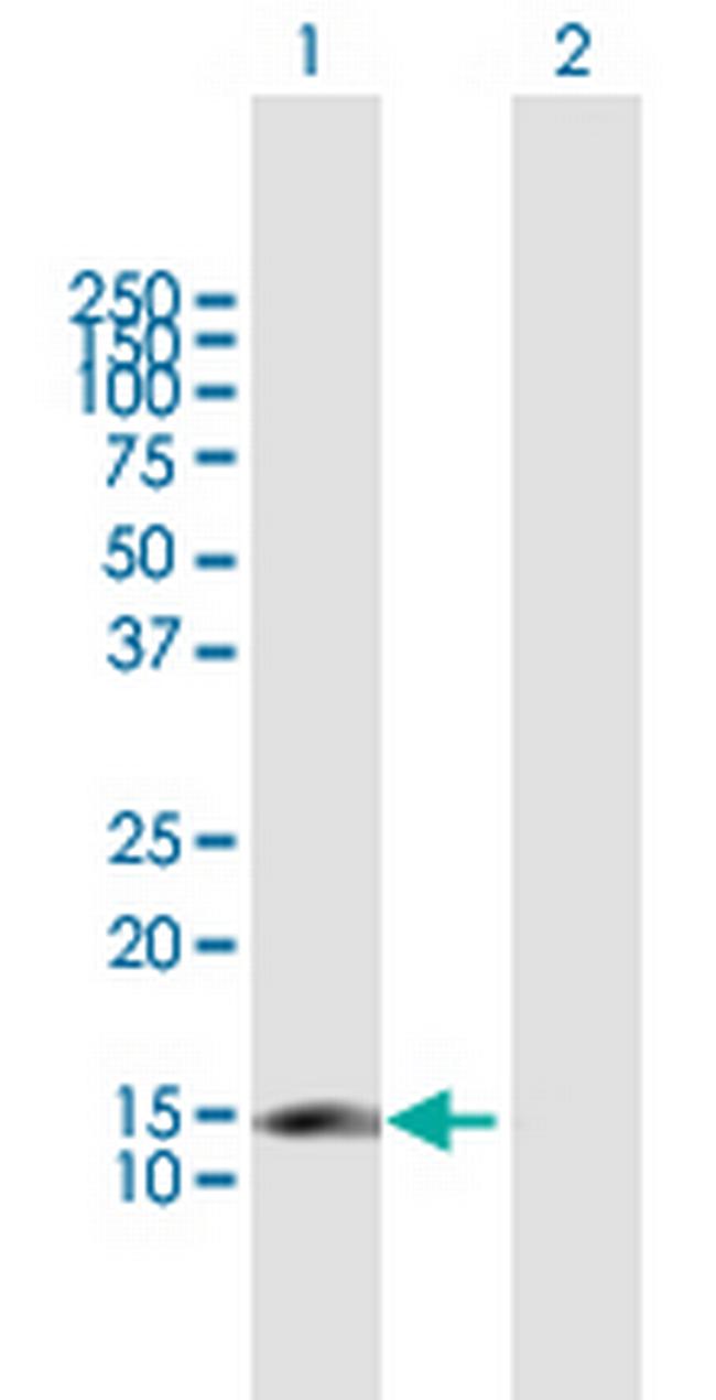 CDKN2C Antibody in Western Blot (WB)