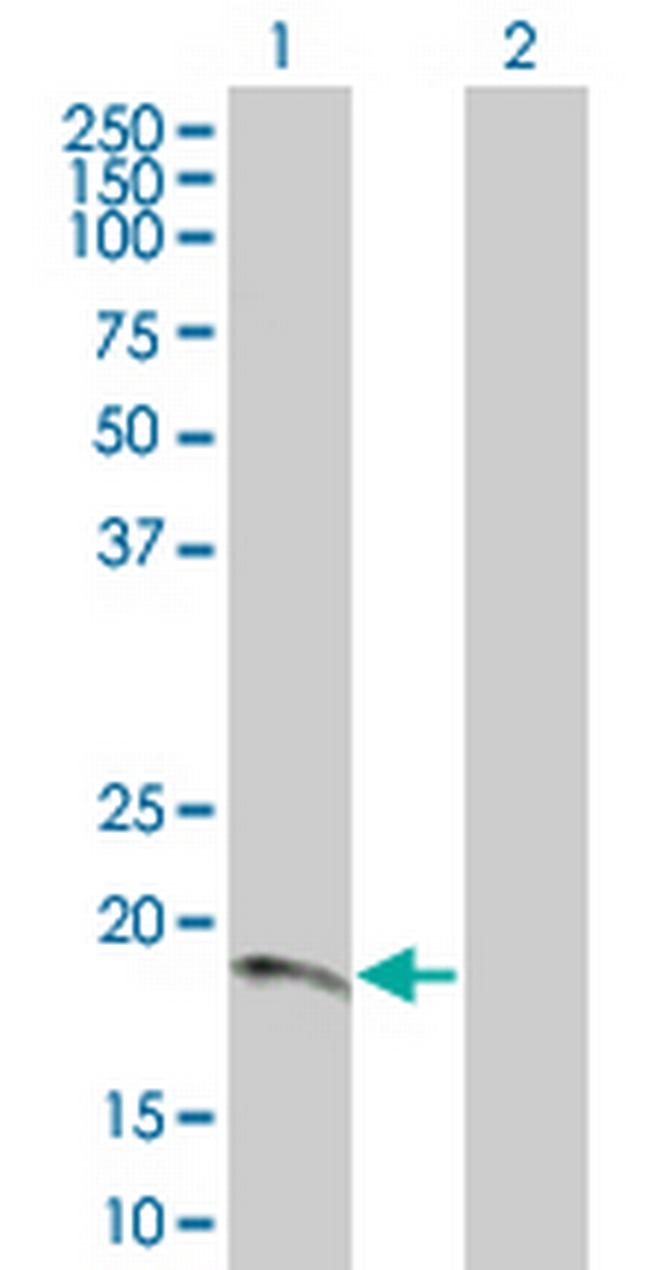 CDKN2D Antibody in Western Blot (WB)