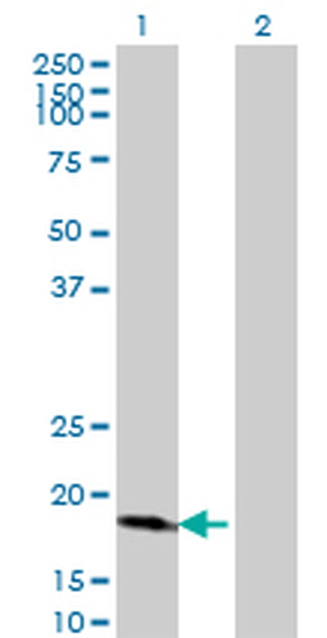 CDKN2D Antibody in Western Blot (WB)