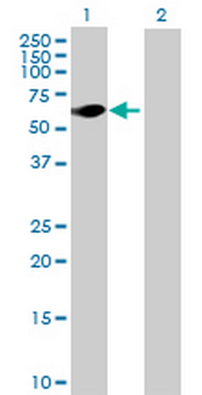 CDR2 Antibody in Western Blot (WB)