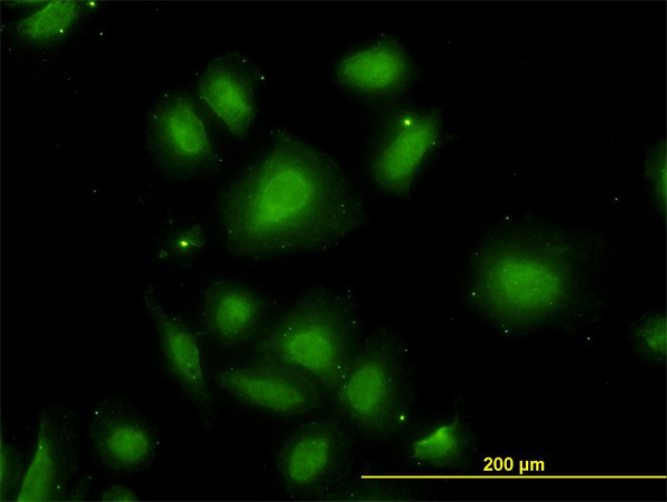 CDR2 Antibody in Immunocytochemistry (ICC/IF)