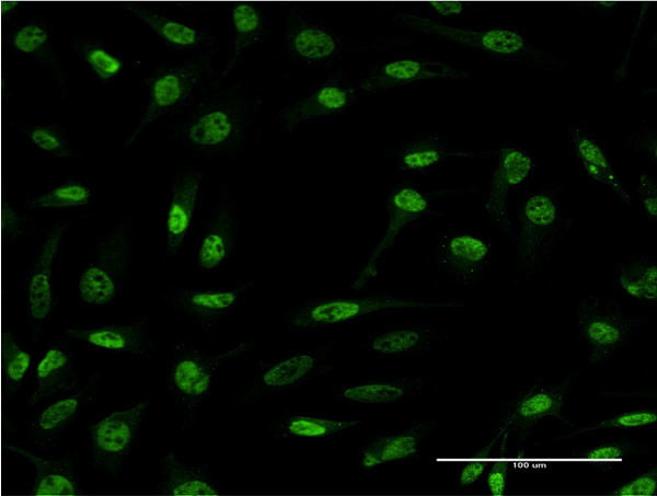 CDR2 Antibody in Immunocytochemistry (ICC/IF)