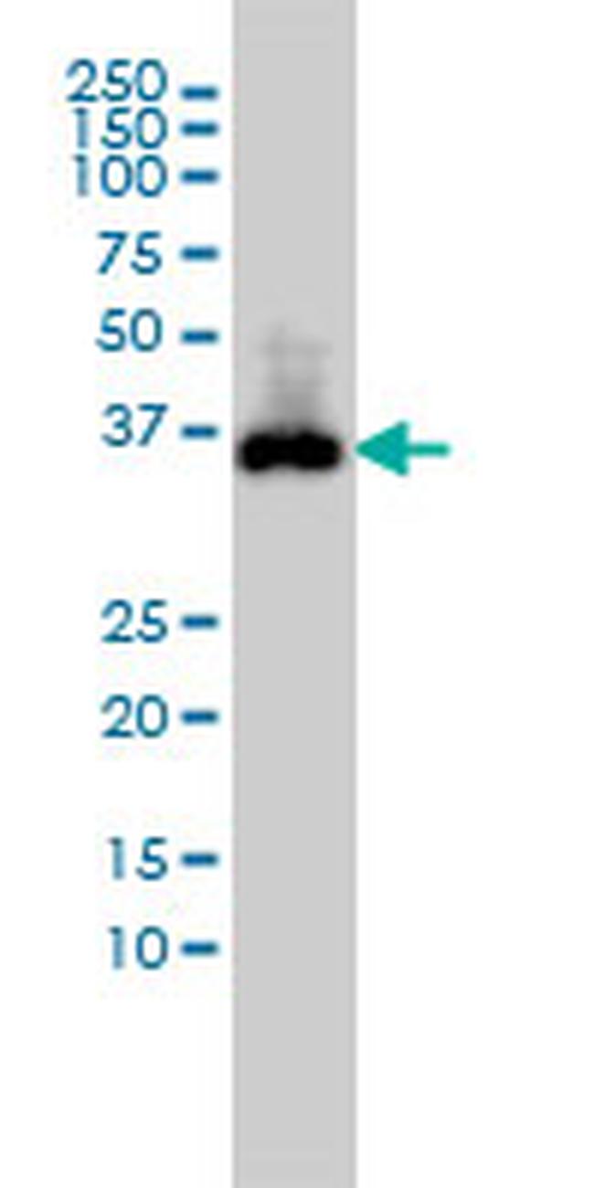 CDX2 Antibody in Western Blot (WB)