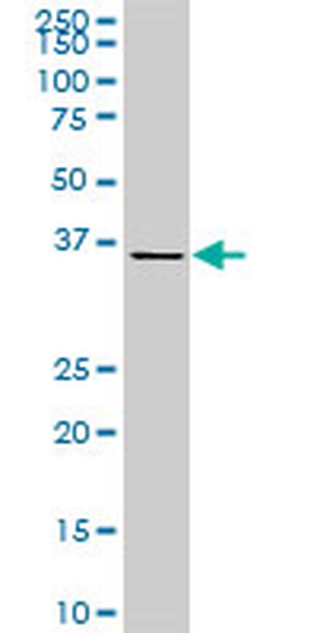 CDX4 Antibody in Western Blot (WB)