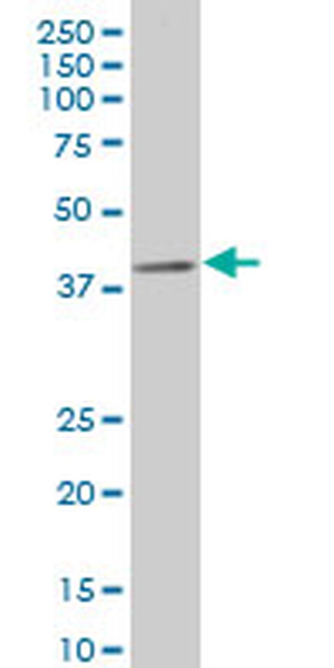CDX4 Antibody in Western Blot (WB)