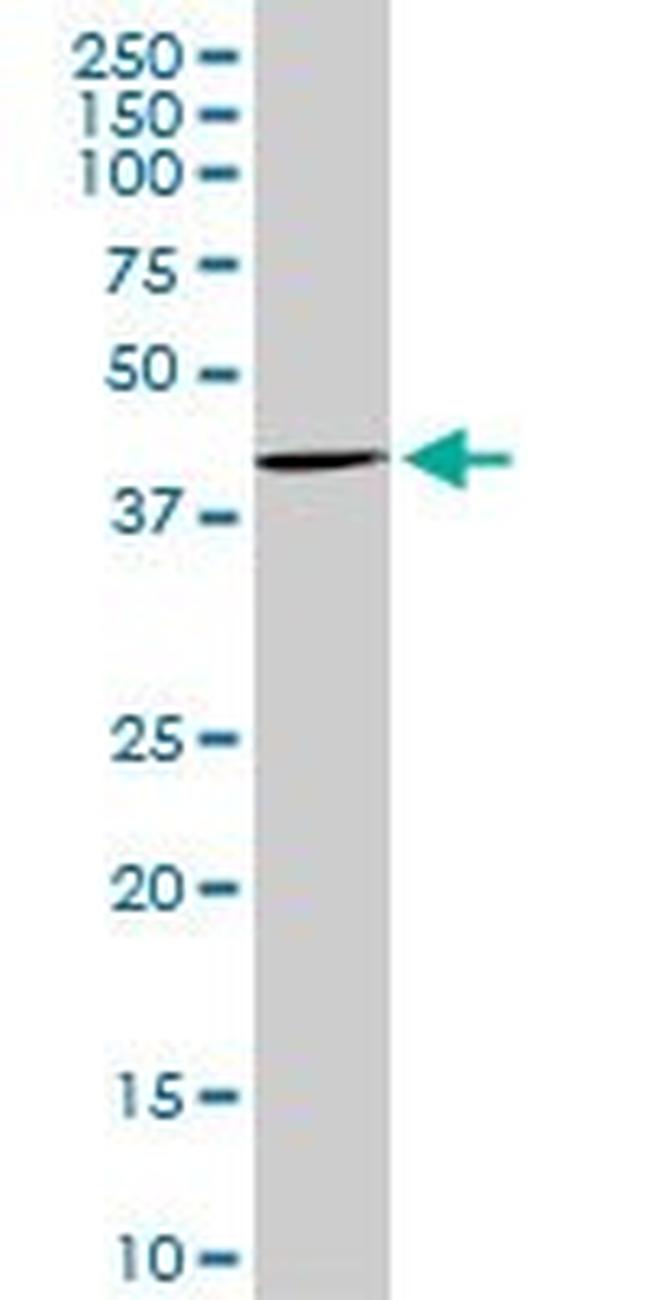 CDX4 Antibody in Western Blot (WB)