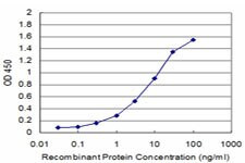 CENPA Antibody in ELISA (ELISA)